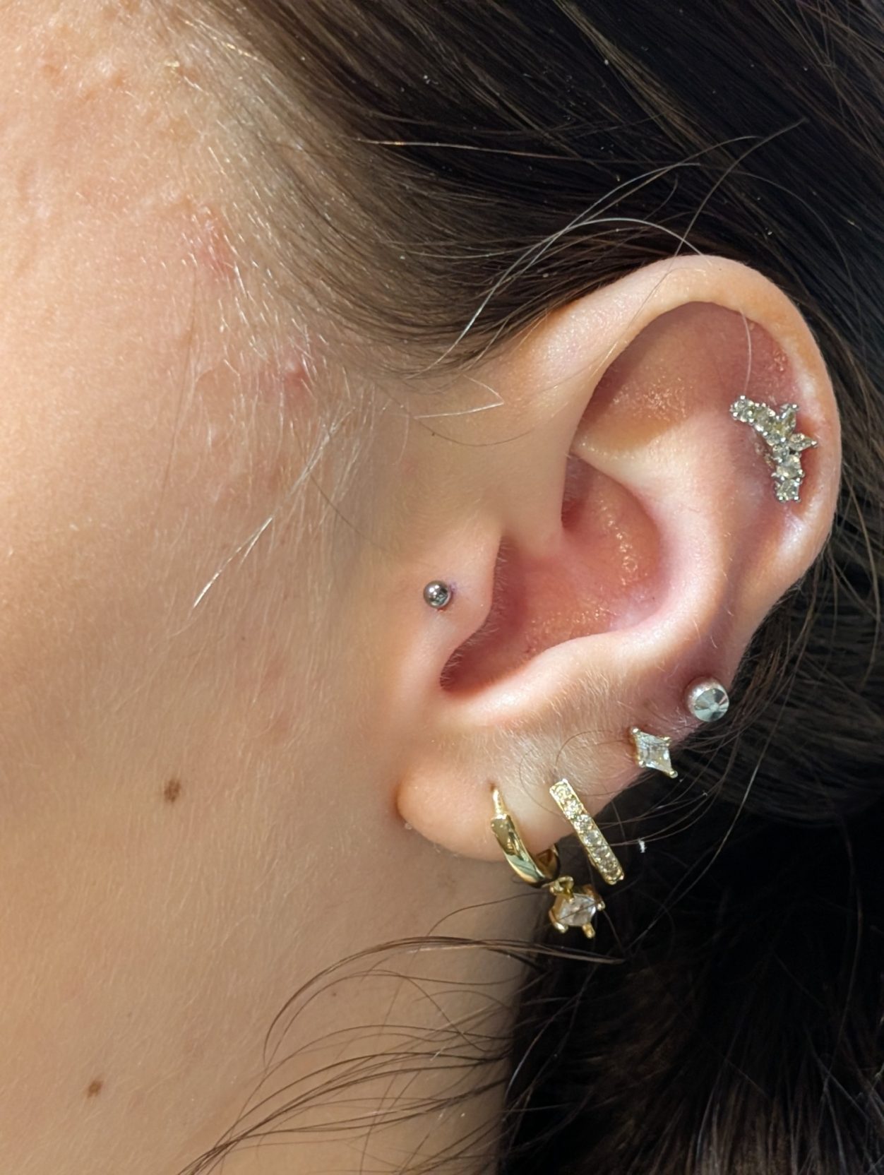 Tragus